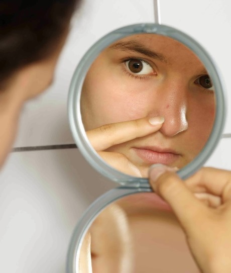 Trị mụn tại nhà